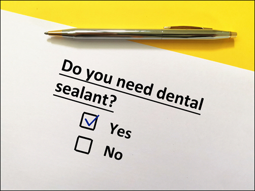 Dental Sealants