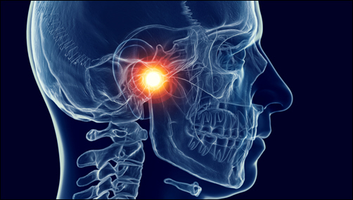 TMJ Disorders