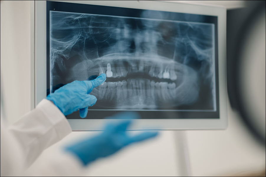 Digital X-rays